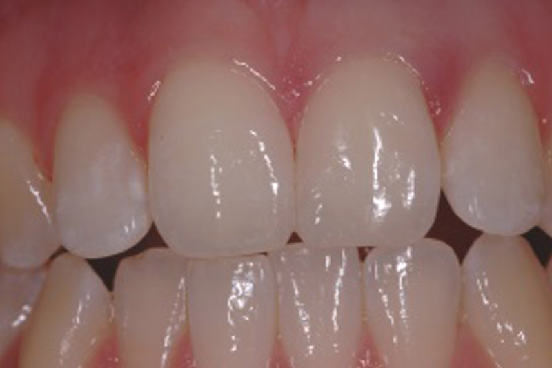 Dental Treatments Dublin 18