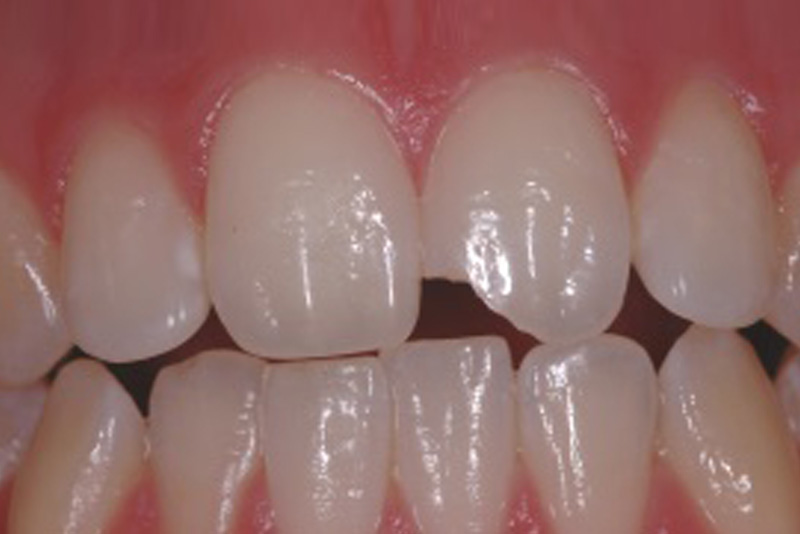 Dental Treatments Dublin 18