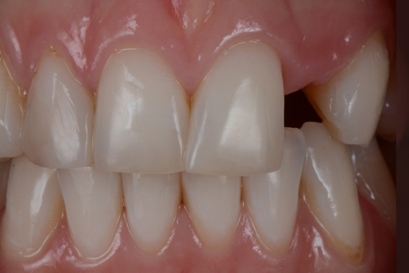 Dental Treatments Dublin 18