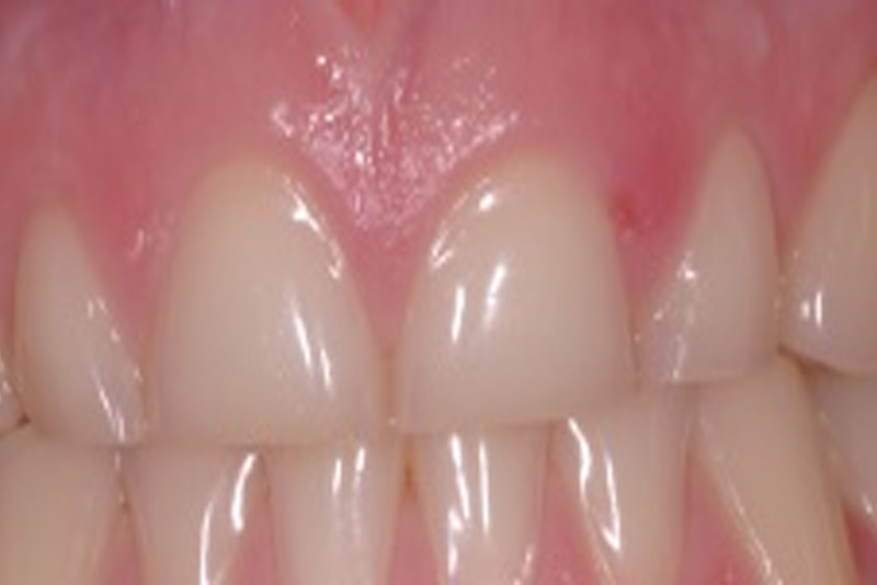 sd2 Dental Clinic Dublin